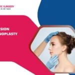 Revision Rhinoplasty