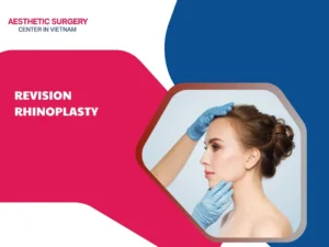 Revision Rhinoplasty