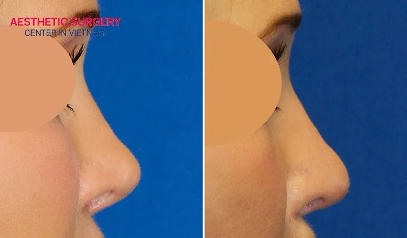 Aesthetic Surgery Center is a reputable cosmetic clinic.