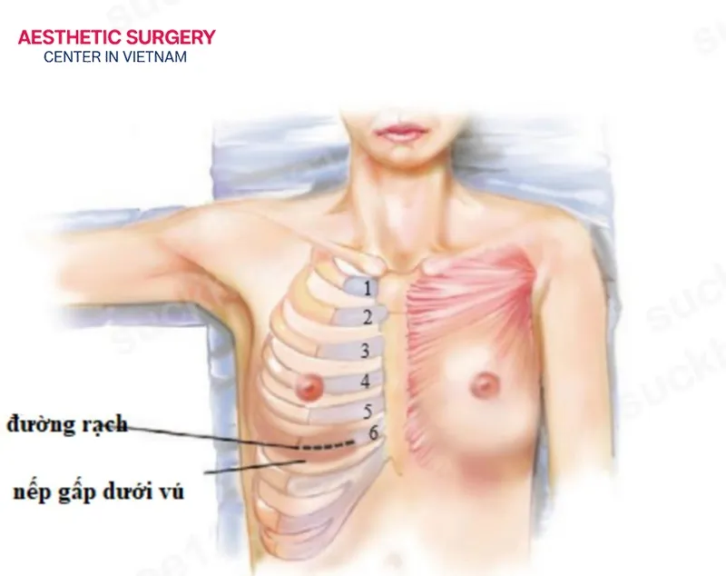 A thin new layer of cartilage will regenerate within 6 to 12 months.