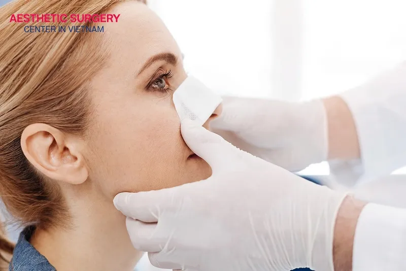 Side effects after rhinoplasty are usually mild and temporary.
