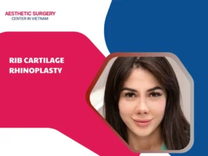 Rib cartilage rhinoplasty