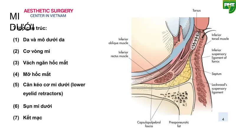 Lower Eyelid Anatomy to Understand the Aesthetic Method