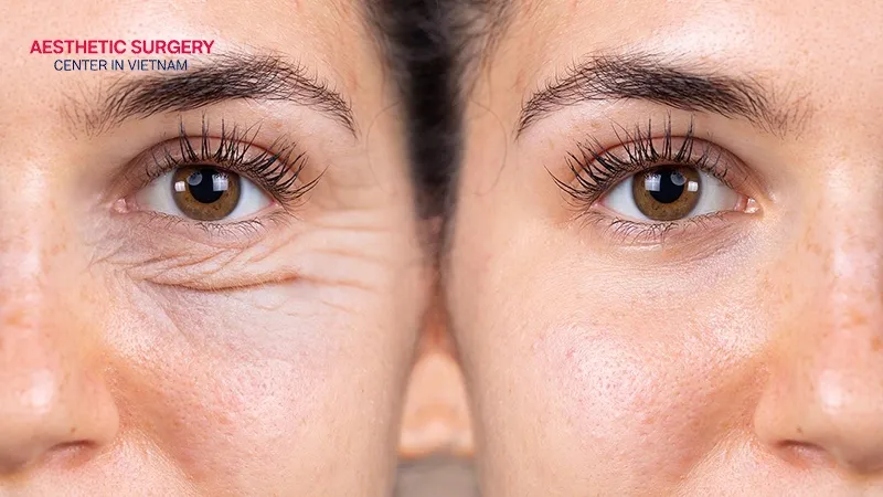 You need to ensure good health before undergoing surgery.