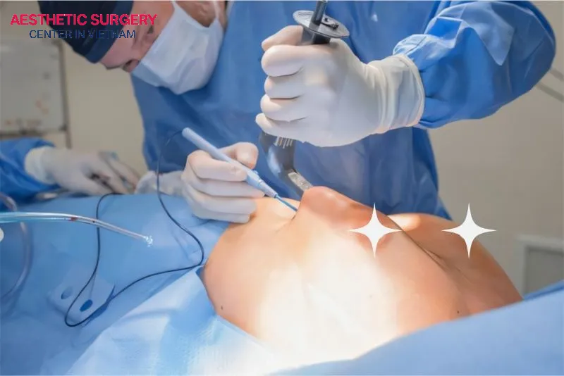 Frequently asked questions and answers about breast augmentation surgery