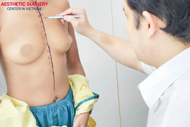 Surgeons at Aesthetic Surgery Center will take measurements and provide consultations to determine the appropriate size for each client.