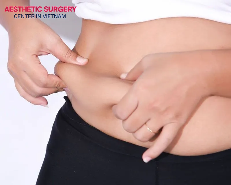 Liposuction can only remove about 5–7 liters of fat, so it cannot be used to lose dozens of kilograms.