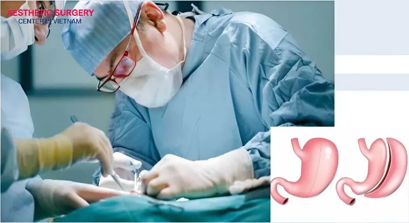 Weight loss surgery can help improve obesity-related conditions such as diabetes and high blood pressure.