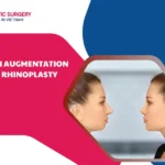 chin augmentation and rhinoplasty