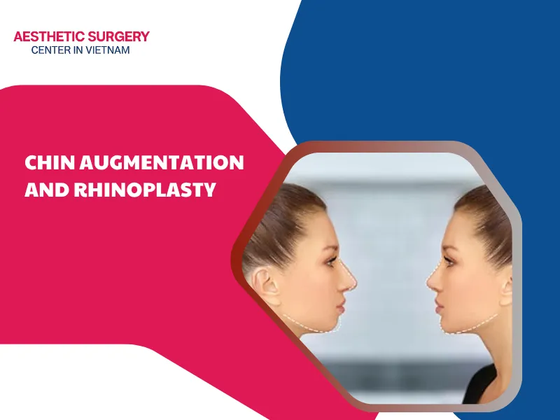 chin augmentation and rhinoplasty