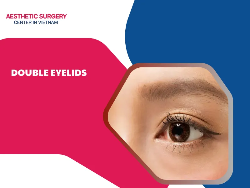 double eyelids