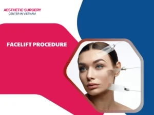 facelift procedure