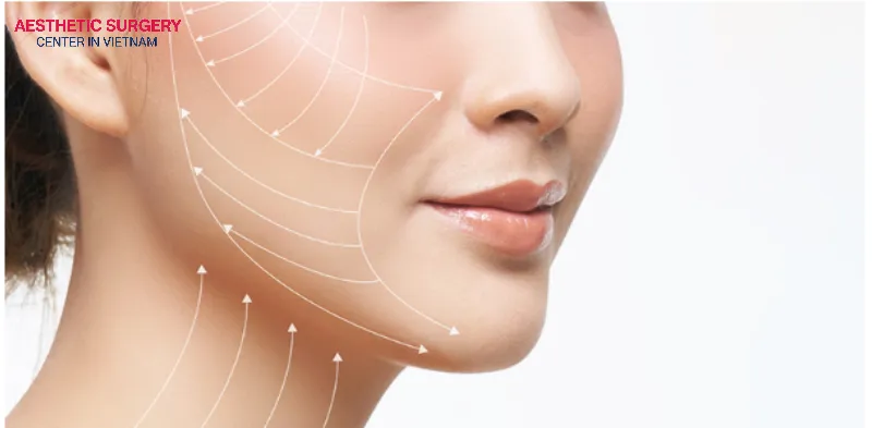 A facelift helps tighten all visible signs of facial aging, bringing a youthful and refreshed appearance to the patient.