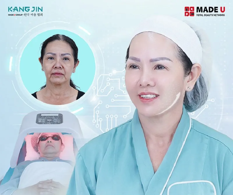 Client images before and after performing full facelift at KangJin Vietnam