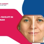 Full facelift in vietnam