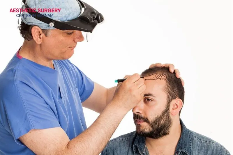 The surgeon will measure hair density and identify thinning or bald areas to create the most suitable treatment plan for each client.