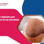 hair transplant clinic in Ho Chi Minh city