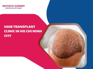 hair transplant clinic in Ho Chi Minh city