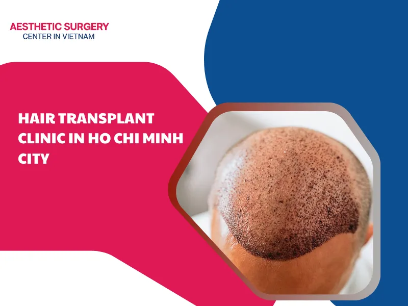 hair transplant clinic in Ho Chi Minh city