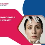 How long does a facelift last?