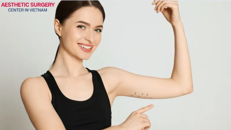 The cost of arm liposuction in Vietnam is much lower compared to having the procedure abroad.