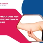 how much does arm liposuction cost in vietnam