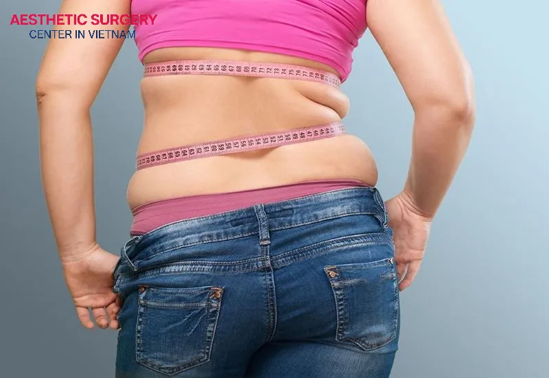 Should you choose liposuction or a tummy tuck
