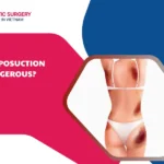 is liposuction dangerous
