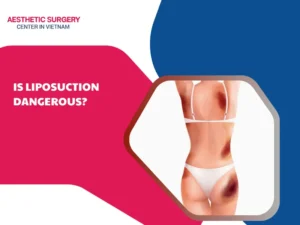 is liposuction dangerous