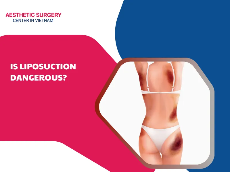 is liposuction dangerous