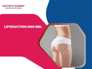 Liposuction and bbl