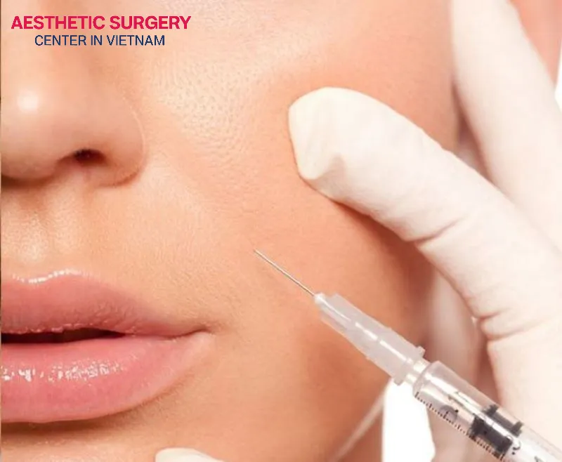 Correctly identifying the nasolabial fold injection site is essential to achieving a natural-looking result without swelling or facial distortion