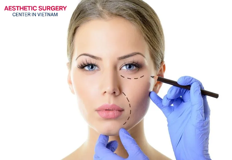 Recognizing the correct piriform fossa location is key to safe and effective filler treatment