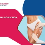 thigh liposuction