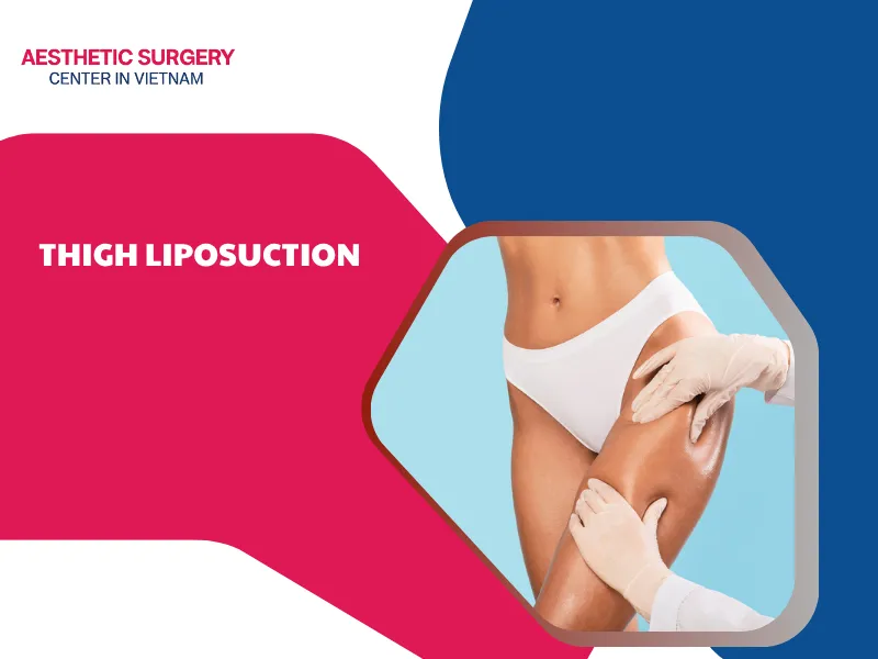 thigh liposuction