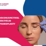 Transconjunctival Lower Eyelid Blepharoplasty