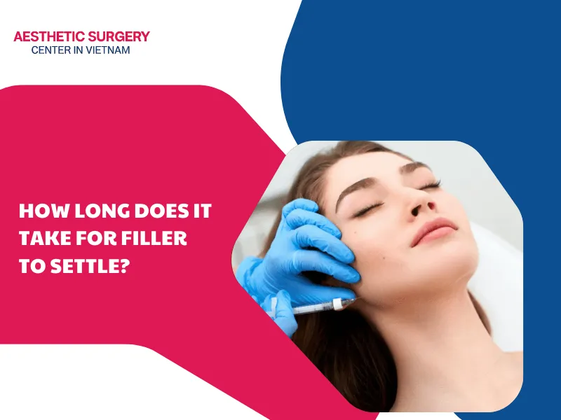 How long does it take for filler to settle? Expert detailed insights
