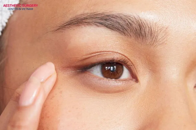 Avoiding eggs in the early stage will help the eyelids settle into a beautiful shape and allow the incision to heal naturally.