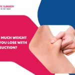 How much weight can you lose with liposuction