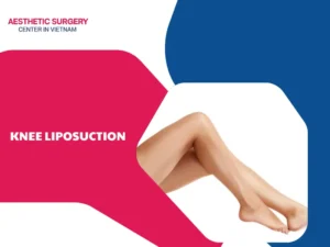Knee liposuction: Create perfect leg balance