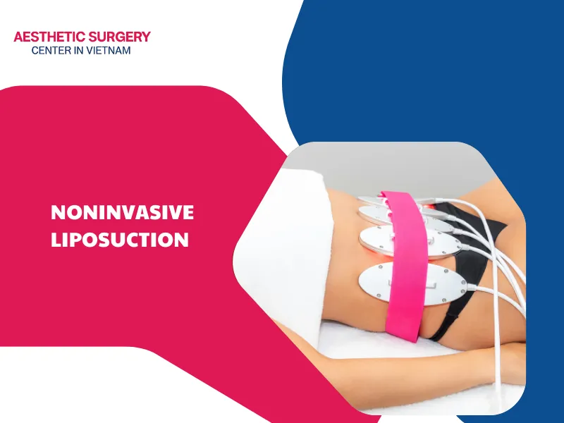Noninvasive liposuction – The pros and cons of this method