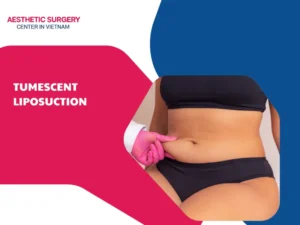 Tumescent liposuction