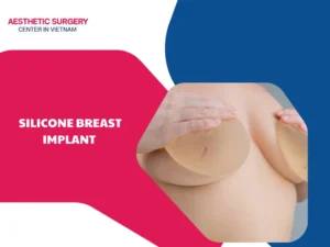 Silicone breast implant – A popular beauty solution for women