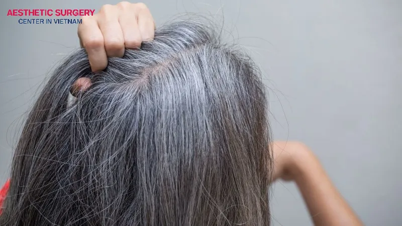 You can absolutely get a hair transplant even if you have gray hair.