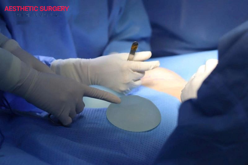 Breast implant displacement from its original position can result from overly loose breast tissue or improper implant placement technique.