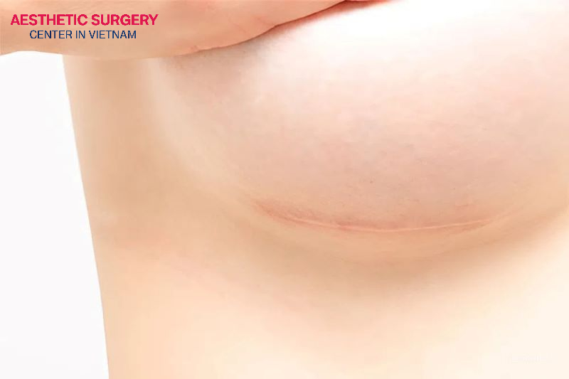 If you are unhappy with the appearance of a scar, treatments such as steroid injections or microneedling can be performed.