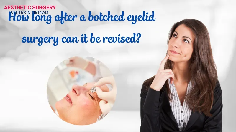 If your eyelid surgery results are unsatisfactory, you should wait 3–6 months for the wound to stabilize before undergoing a revision procedure.