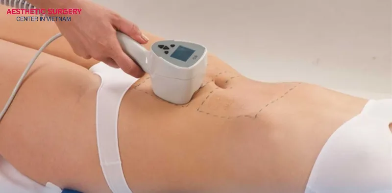 Laser Lipo technology supports fat removal of up to 98%.