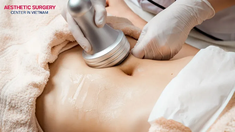 CHIFU technology uses high-intensity focused ultrasound to destroy fat cells.