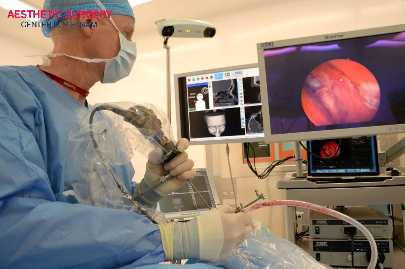 Endoscopic Septoplasty procedure.